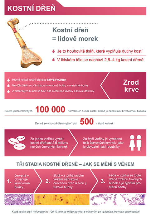 infografika_kostni dren_havas_ilustrfoto